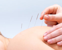 Naturopathic CE Acupuncture Courses for Back Pain
