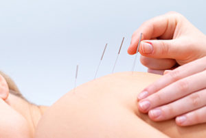 Naturopathic CE Acupuncture Courses for Back Pain